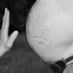 Segnali del fegato grasso: sintomi visibili su un corpo umano, evidenziando cambiamenti fisici e salute.